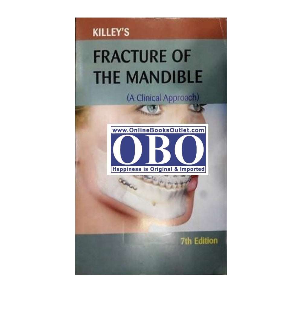 Front cover of "Killeys Fracture of the Mandible Author(s): Peter Banks, H C Killey" – now available with express shipping and COD.