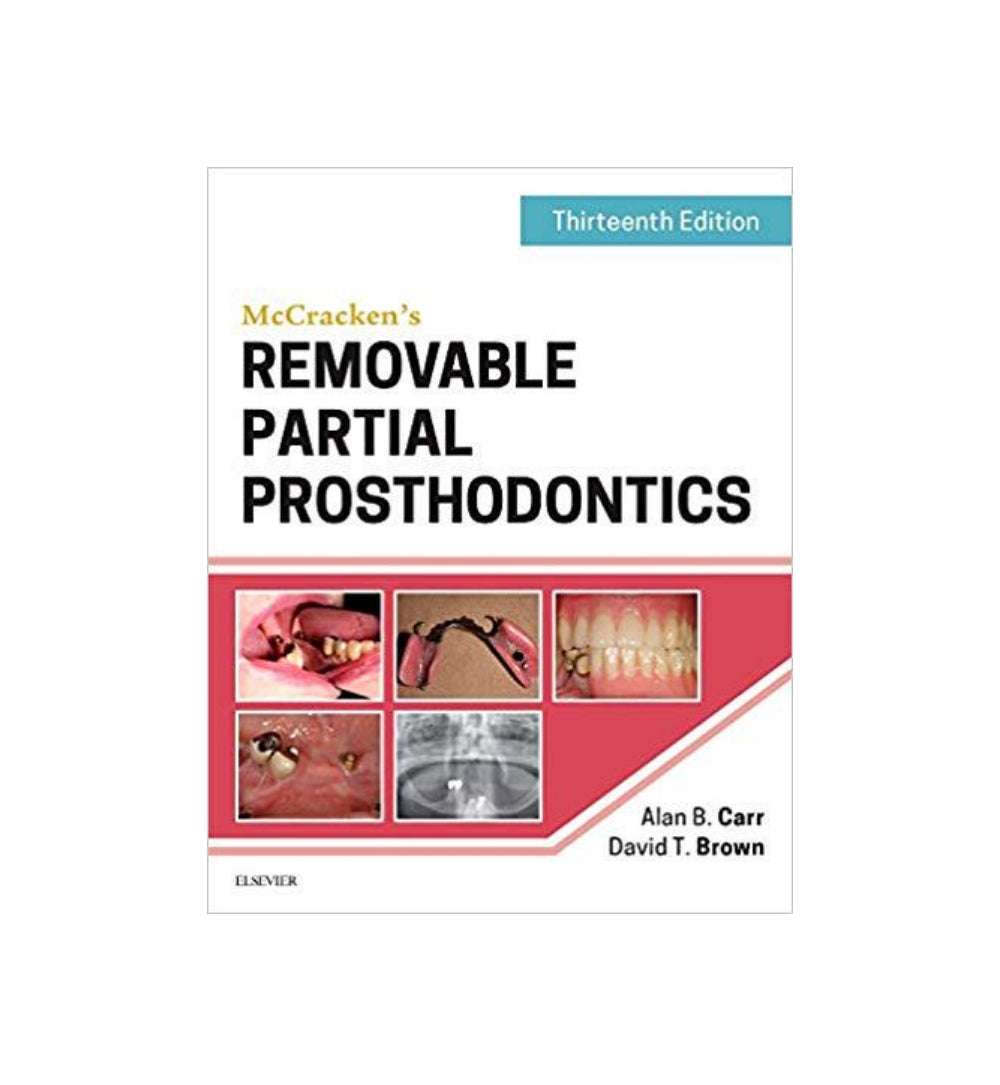 McCrackens Removable Partial Prosthodontics Alan b Carr David t Brown