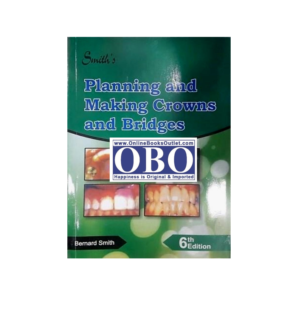 Cover shot of "Smiths Planning and Making Crown and Bridges Author(s): Bernard G. N. Smith" – top-selling title with fast delivery options.