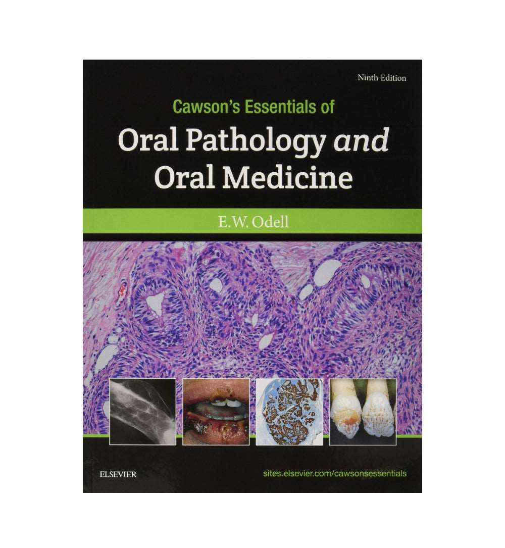 front-cover-cawsons-essentials-of-oral-pathology-and-oral-medicine-9th-edition-author-edward-w-odell-available-online