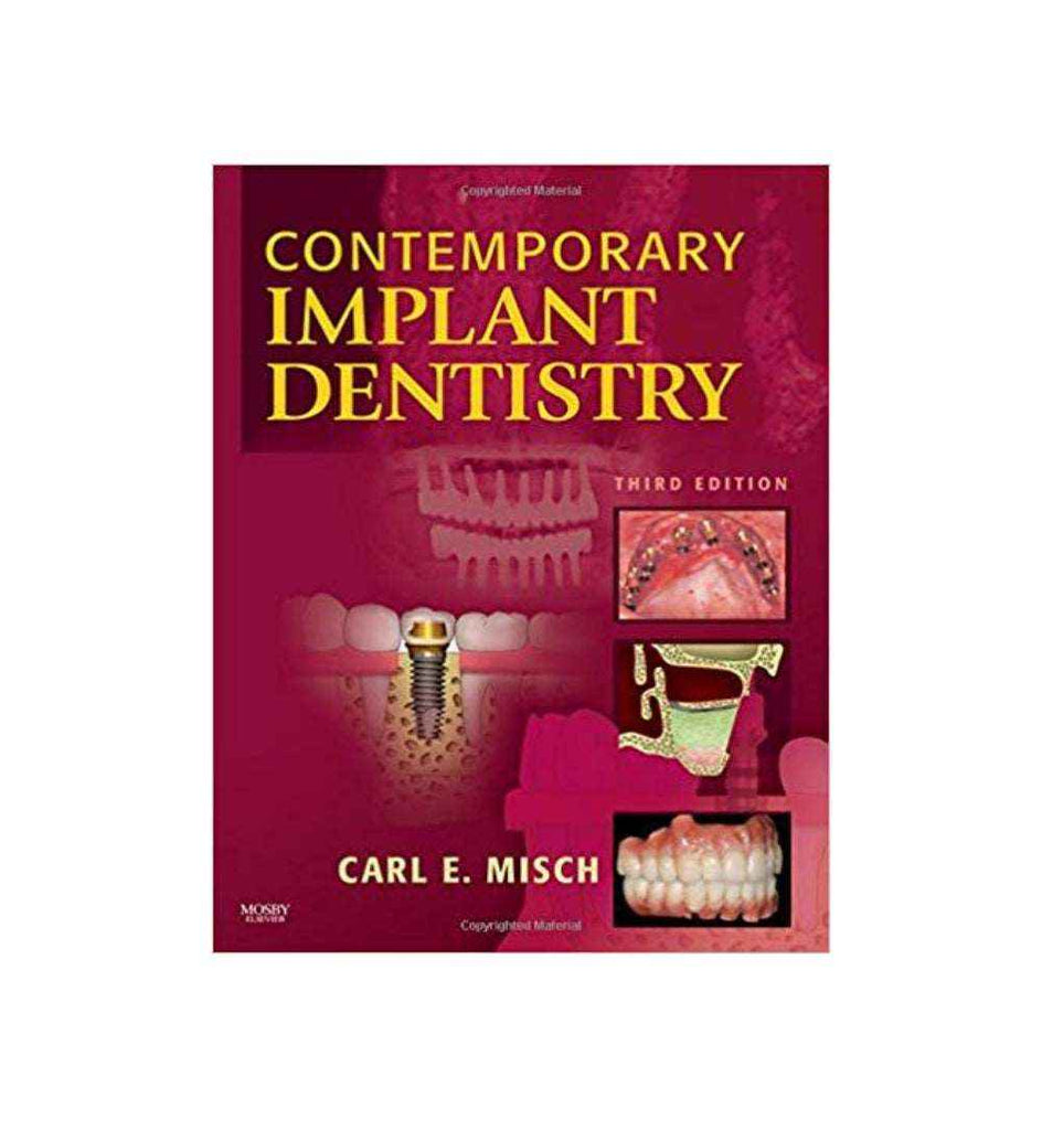 Contemporary Implant Dentistry 3rd Edition Author(s): Carl E. Misch ...