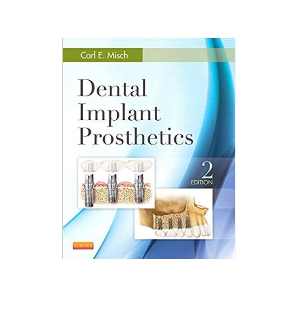 dental-implant-prosthetics-by-carl-e-misch-2nd-edition-authors-carl-e-misch - OnlineBooksOutlet