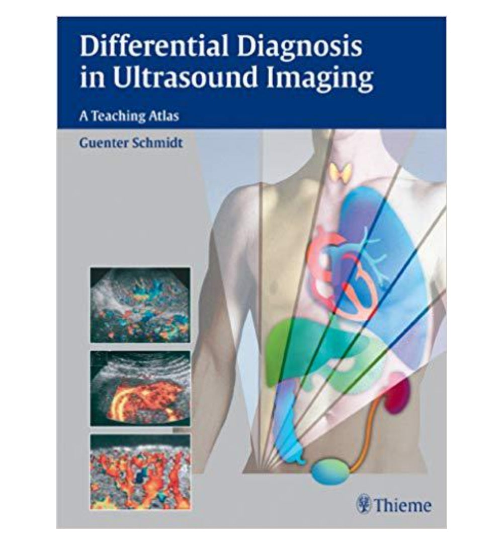 differential-diagnosis-in-ultrasound-imaging-a-teaching-atlas-1st-edition-edition-by-guenter-schmidt - OnlineBooksOutlet