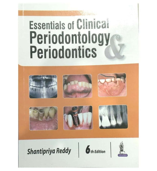 front-cover-essentials-of-clinical-periodontology-amp-periodontics-5th-edition-by-shantipriya-reddy-available-online