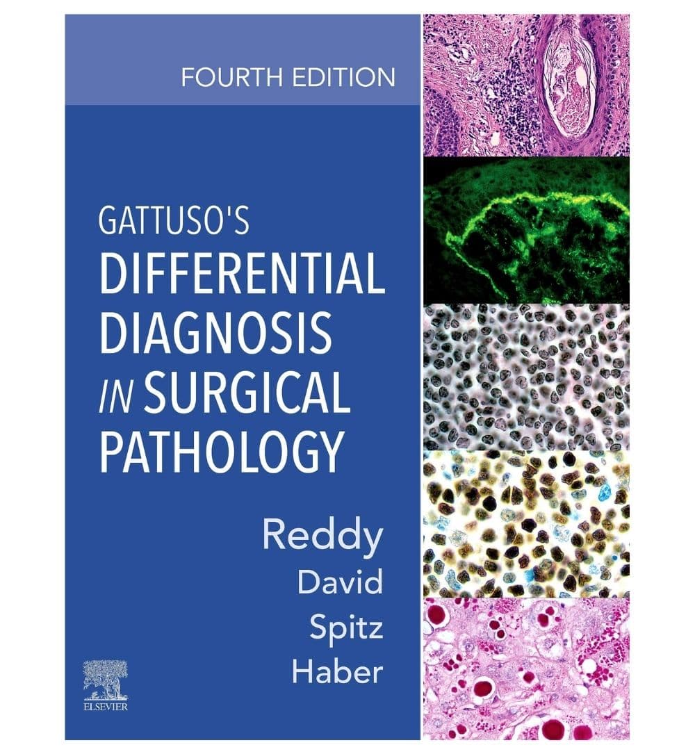 buy-gattusos-differential-diagnosis-in-surgical-pathology-online - OnlineBooksOutlet