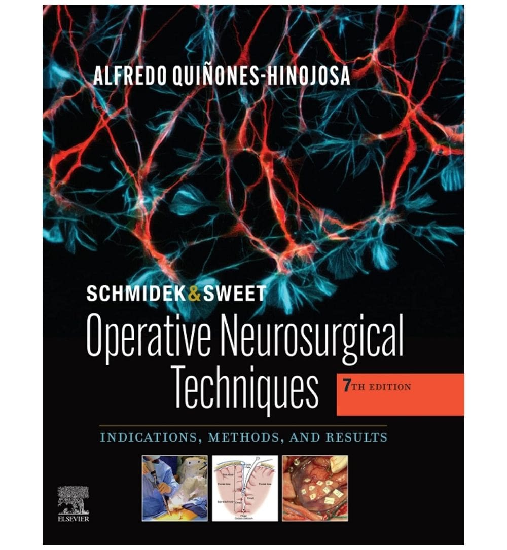 buy-operative-neurosurgical-techniques-online - OnlineBooksOutlet