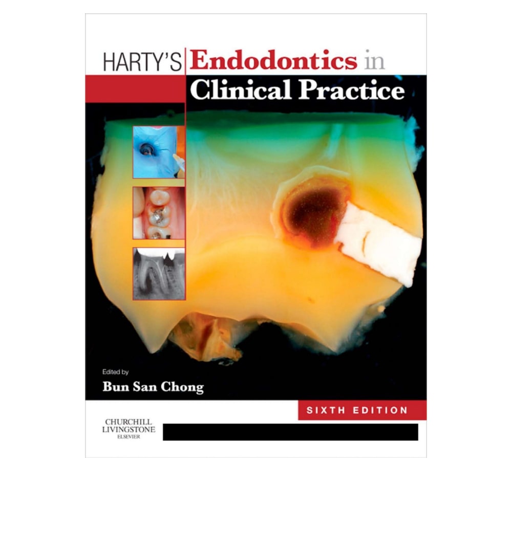 hartys-endodontics-in-clinical-practice - OnlineBooksOutlet