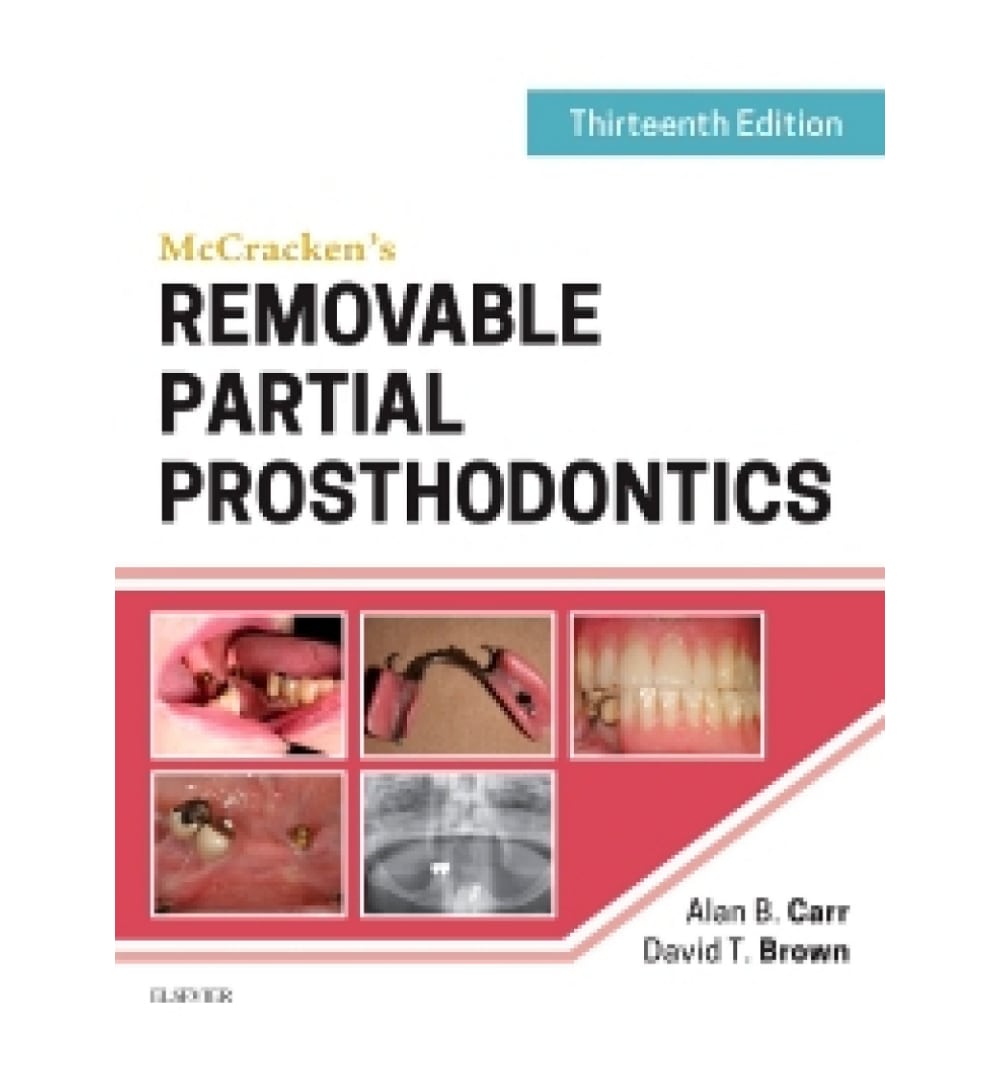 mccrackens-removable-partial-prosthodontics-book - OnlineBooksOutlet